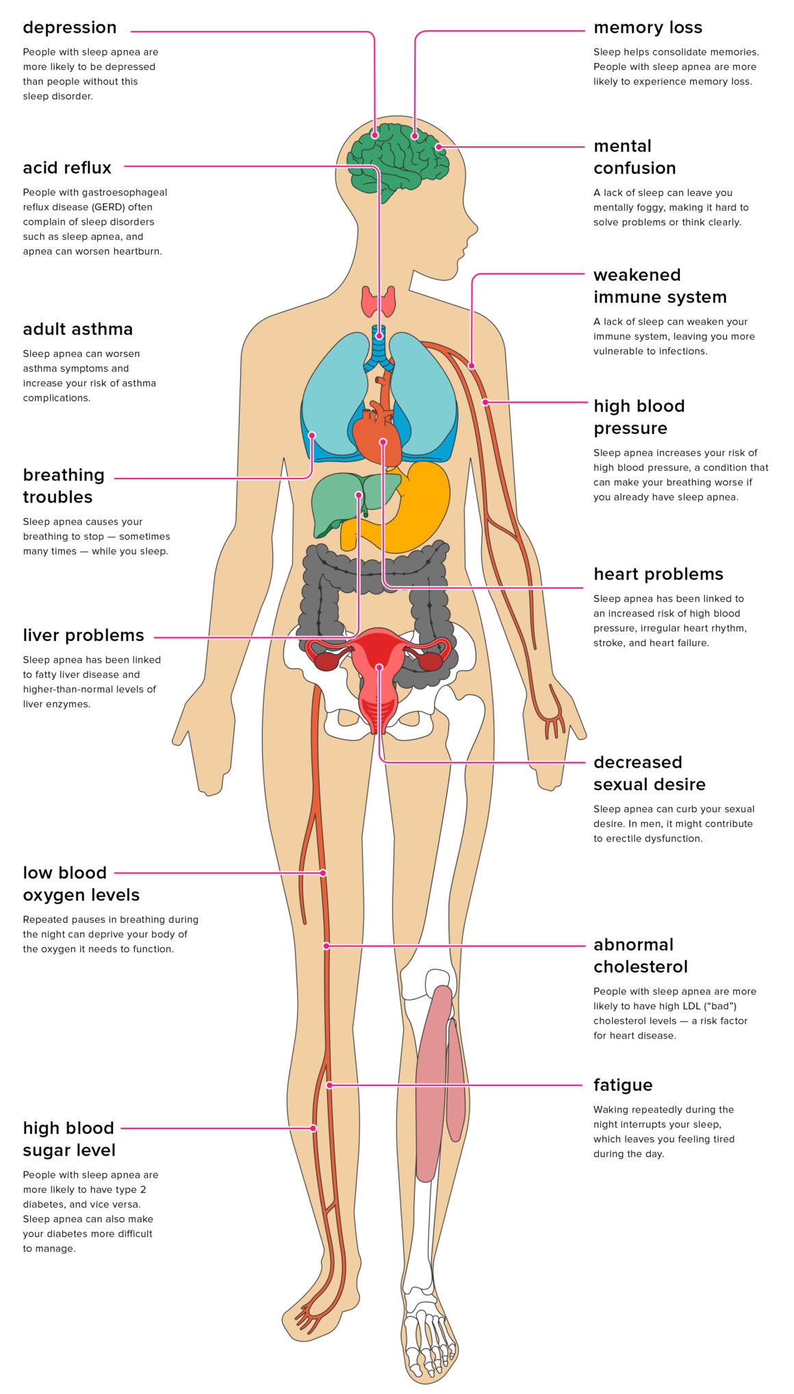 Sleep Apnea Effects on the Body (Credit: Healthline)